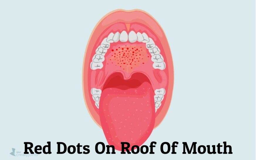 Red Dots On Roof Of Mouth